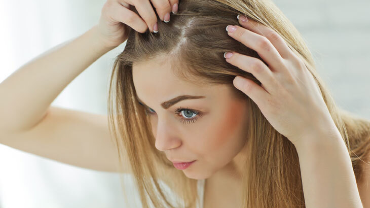 Saç Dökülmesi (Alopesia) Nedir, Neden Olur? Belirtileri ve Temel Nedenleri